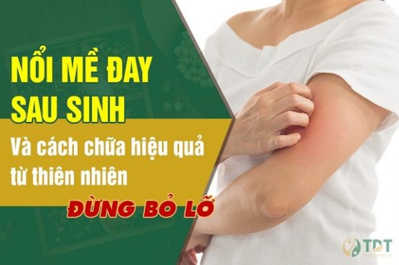 Mề đay mẩn ngứa sau sinh