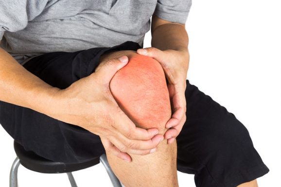 bệnh tràn dịch khớp gối