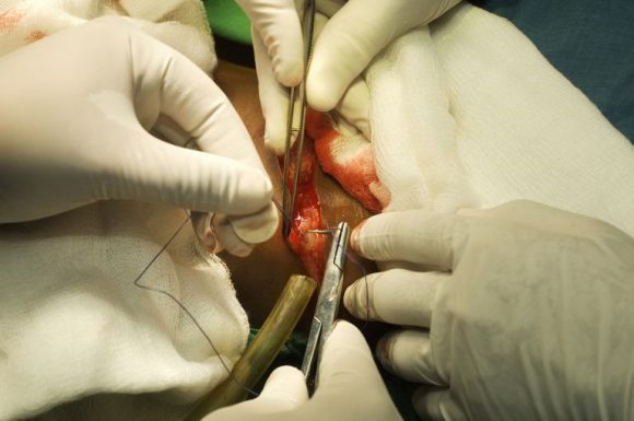 Người bệnh thoát vị đau nặng, khó vận động sẽ được chỉ định phẫu thuật