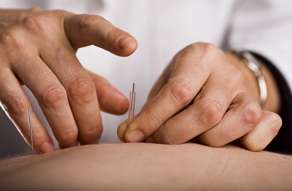 Các thông tin cần biết về phương pháp châm cứu chữa đau dạ dày