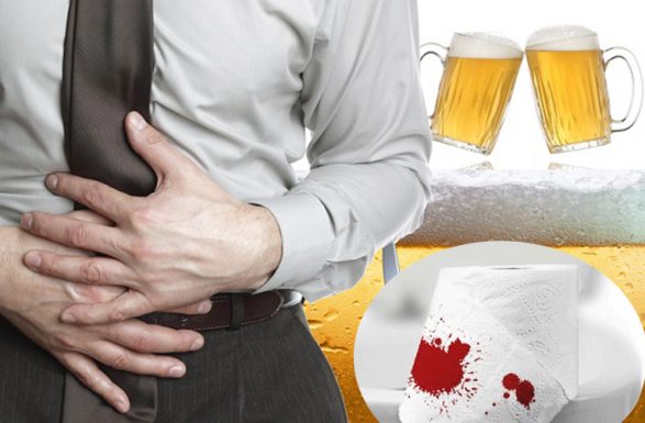 đi ngoài ra máu sau khi uống rượu bia