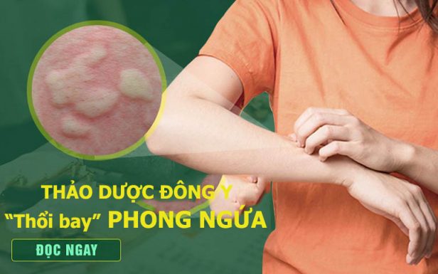 Bài thuốc Tiêu ban Giải độc thang đặc trị phong ngứa