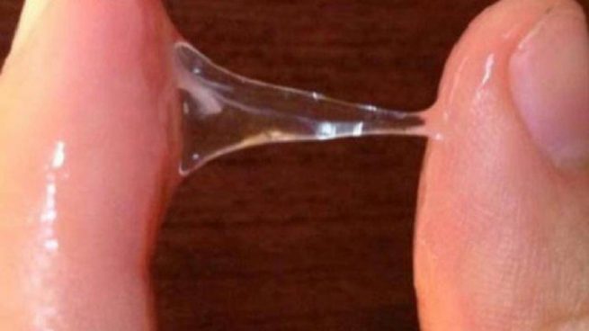 Huyết trắng bình thường có mùi gì, màu gì?