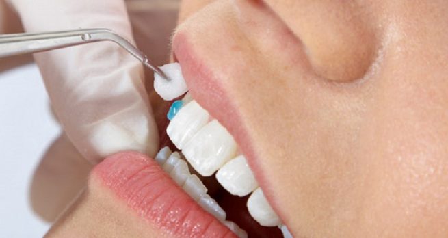 Tới gặp bác sĩ nha khoa để có phương án điều trị bệnh hiệu quả